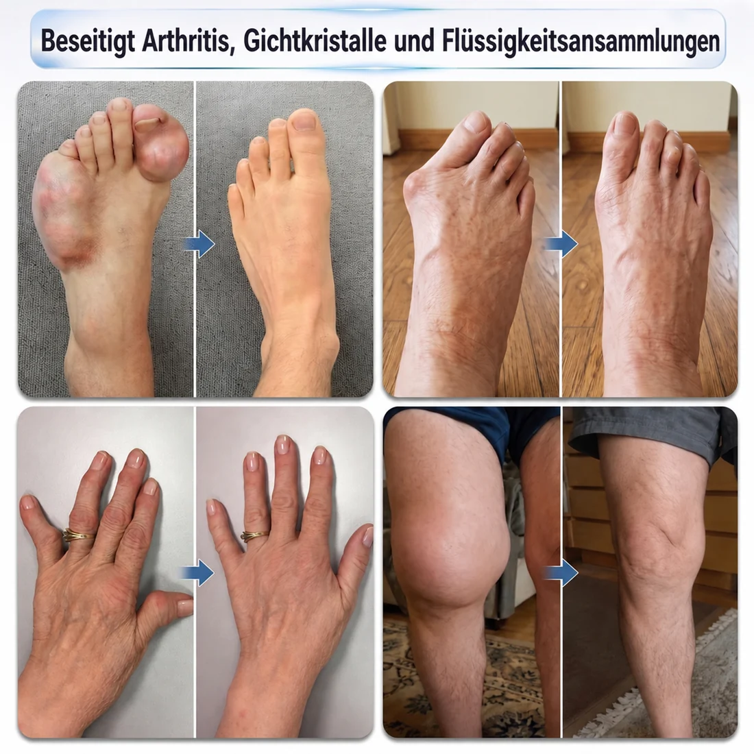 🇩🇪 𝐃𝐑.𝐇𝐎𝐍𝐎𝐑® 💠 Massage Roll-On für Gelenke & Muskeln 🌿 – 10-facher Naturkomplex